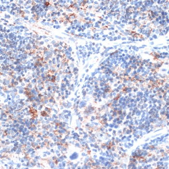 SLAMF7 Antibody