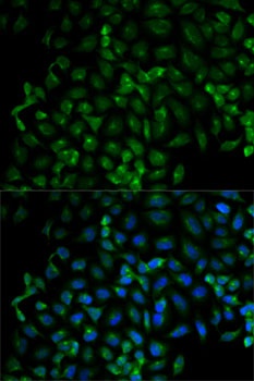 Beta-TRCP Antibody