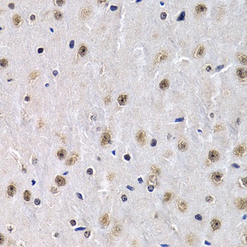 PTHLH Antibody