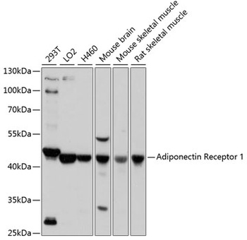 ADIPOR1 Antibody