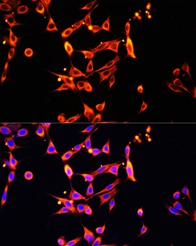 Heparanase 1 Antibody