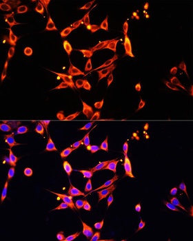 HPSE Antibody