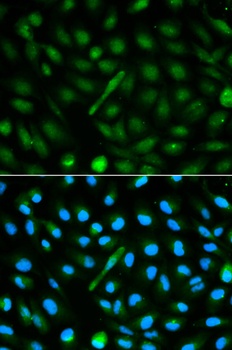 AHSG Antibody