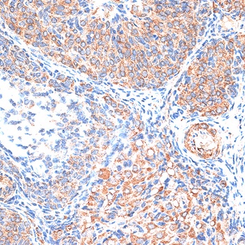 TIMP2 Antibody