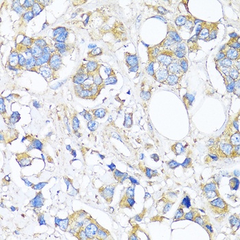 TIMP2 Antibody