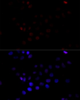 TBP Antibody