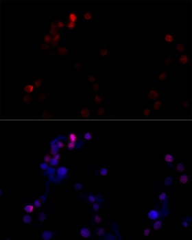 TBP Antibody