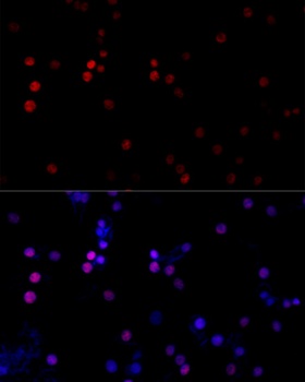 TBP Antibody