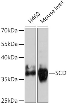 SCD Antibody