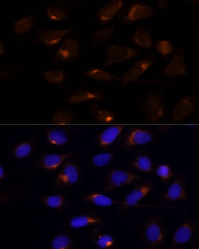 SCD Antibody