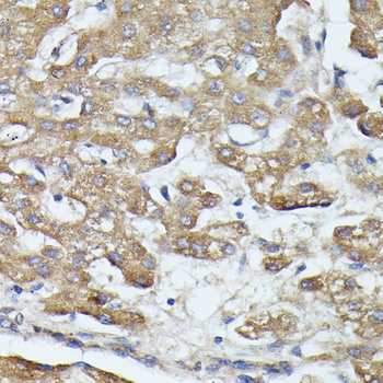 SAA4 Antibody