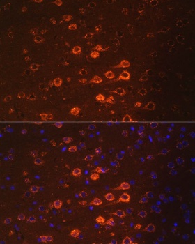 NEFM Antibody