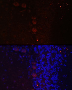 NEFM Antibody