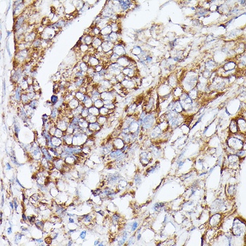 NUBP1 Antibody