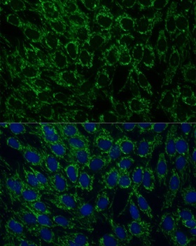 MTIF2 Antibody