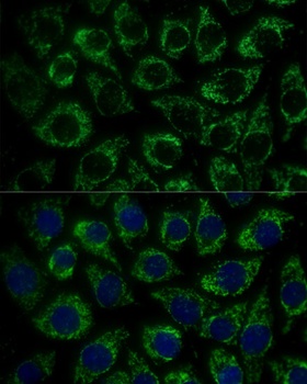 MTIF2 Antibody