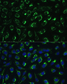 MTIF2 Antibody