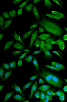 FGD1 Antibody