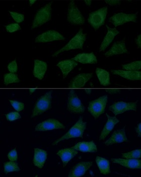 FGD1 Antibody