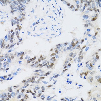 CDK6 Antibody