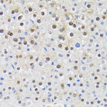 CDK6 Antibody