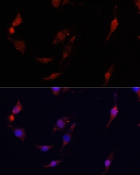 CDK6 Antibody