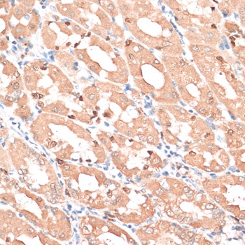 HMGA1 Antibody