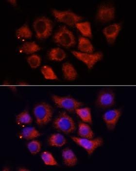 HMGA1 Antibody