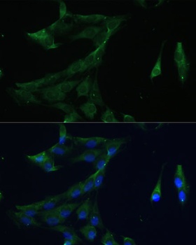 ARL3 Antibody