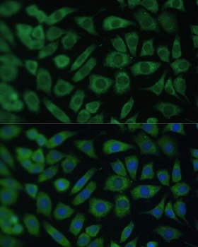 ARL3 Antibody