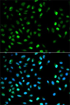 DTNBP1 Antibody