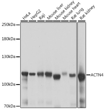 ACTN4 Antibody