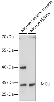 MCU Antibody