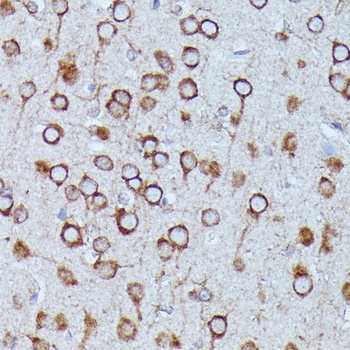 DDX6 Antibody