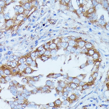 DDX6 Antibody