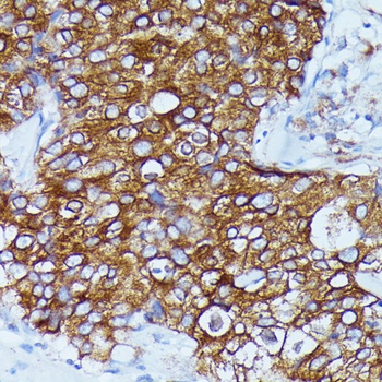 DDX6 Antibody