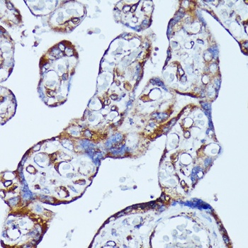 DDX6 Antibody