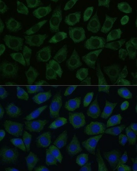 DDX6 Antibody