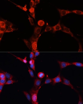 SMPD1 / ASM Antibody