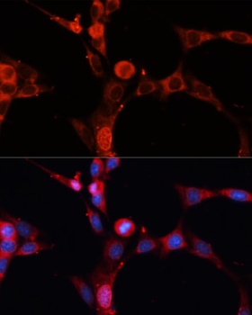 SMPD1 Antibody