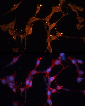 LPL Antibody