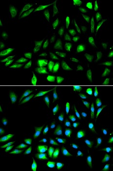 KPNA2 Antibody