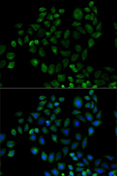 FABP2 Antibody