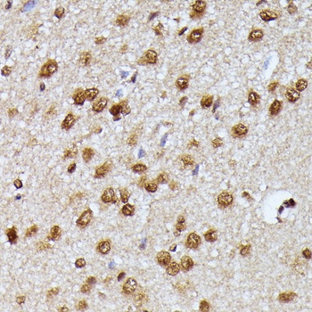 KIAA1429 Antibody