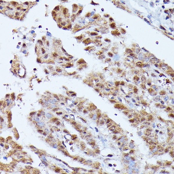 KIAA1429 Antibody