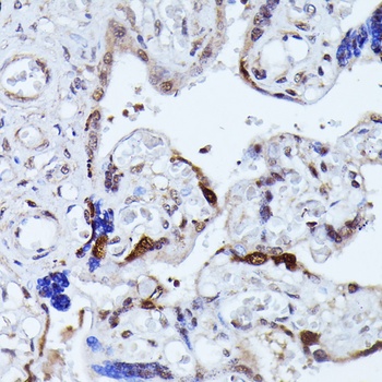 KIAA1429 Antibody