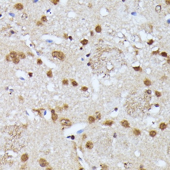 KIAA1429 Antibody