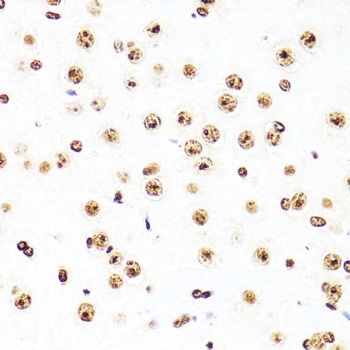 TriMethyl-Histone H3-K27 mAb