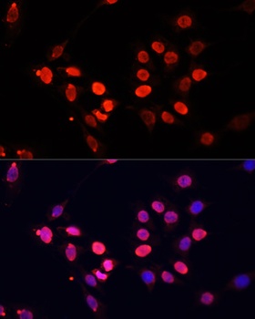 TriMethyl-Histone H3-K27 mAb