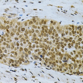 TriMethyl-Histone H3-K27 mAb